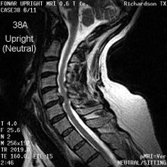 MRI of the L-spine