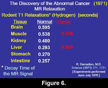 Fig 5. The Discovery of the Abnormal Cancer MR Relaxation