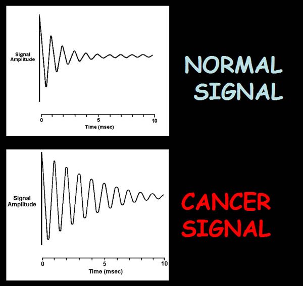 Normal Signal vs. Cancer Signal