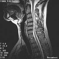 Stand-Up MRI Case Study