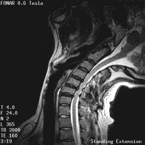 Fonar Stand-Up (TM) MRI Image