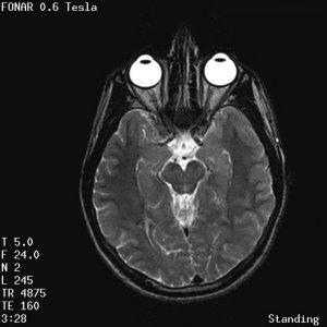 Fonar Stand-Up (TM) MRI Image