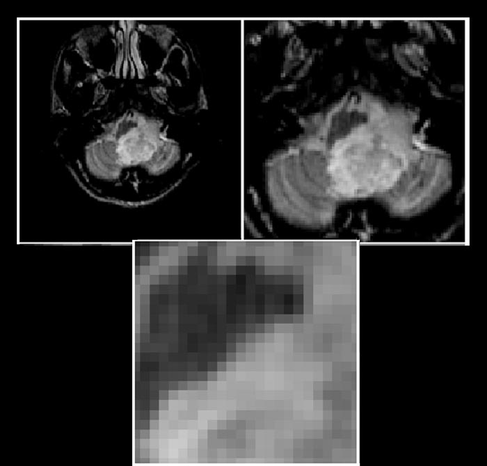 pixels of an MRI image