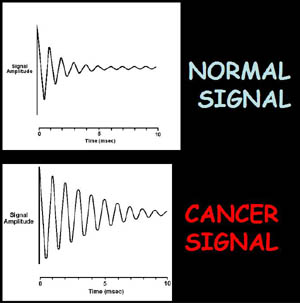 Fig.8. He discovered that the NMR signal amplitudes of cancer tissue differ markedly from the NMR signal amplitudes of the normal tissues because of the differences in their rate of decay. 